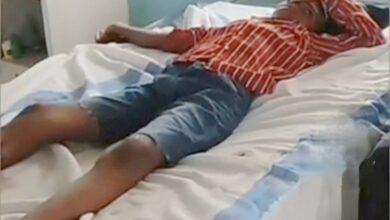 देवास के जलोनी सियापुरा में आवारा कुत्ते के हमले के बाद घायल बच्चा।